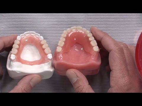 Jaw Relations In Complete Dentures Lecture Milwaukee WI 53293